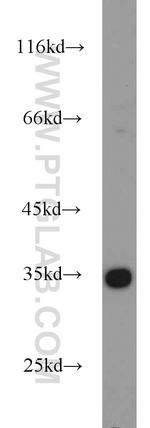 Cyclin G Antibody in Western Blot (WB)