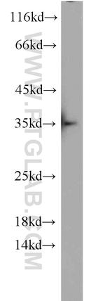 PHF11 Antibody in Western Blot (WB)