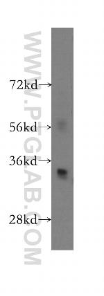 PHF11 Antibody in Western Blot (WB)