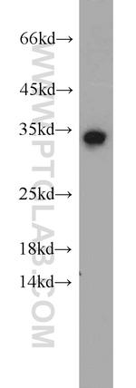 PHF11 Antibody in Western Blot (WB)