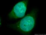 EIF3E Antibody in Immunocytochemistry (ICC/IF)