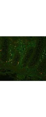 TNF alpha Antibody in Immunohistochemistry (Paraffin) (IHC (P))