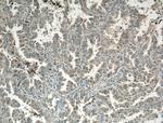 VPS18 Antibody in Immunohistochemistry (Paraffin) (IHC (P))