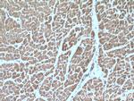 TIMM10B Antibody in Immunohistochemistry (Paraffin) (IHC (P))