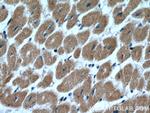 TIMM10B Antibody in Immunohistochemistry (Paraffin) (IHC (P))