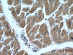TIMM10B Antibody in Immunohistochemistry (Paraffin) (IHC (P))