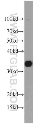 SULT1A1 Antibody in Western Blot (WB)