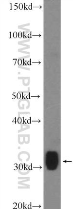 SULT1A1 Antibody in Western Blot (WB)
