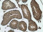 NUDT11 Antibody in Immunohistochemistry (Paraffin) (IHC (P))