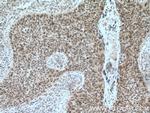 SRp20 Antibody in Immunohistochemistry (Paraffin) (IHC (P))
