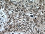 SRp20 Antibody in Immunohistochemistry (Paraffin) (IHC (P))