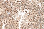 SRp20 Antibody in Immunohistochemistry (Paraffin) (IHC (P))