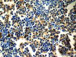 GATA1 Antibody in Immunohistochemistry (Paraffin) (IHC (P))