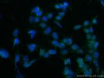 SF3B2 Antibody in Immunocytochemistry (ICC/IF)
