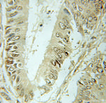 SF3B2 Antibody in Immunohistochemistry (Paraffin) (IHC (P))