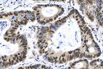 SF3B2 Antibody in Immunohistochemistry (Paraffin) (IHC (P))