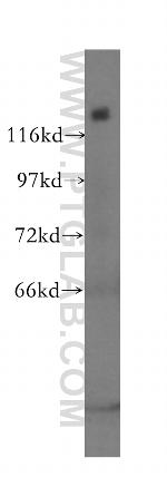 SF3B2 Antibody in Western Blot (WB)