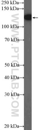 SF3B2 Antibody in Western Blot (WB)