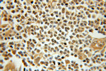 TAF9B Antibody in Immunohistochemistry (Paraffin) (IHC (P))