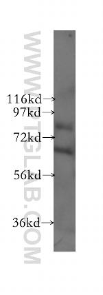 SCNN1A Antibody in Western Blot (WB)
