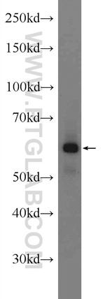SCNN1A Antibody in Western Blot (WB)