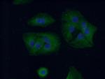 SCNN1A Antibody in Immunocytochemistry (ICC/IF)