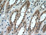SCNN1A Antibody in Immunohistochemistry (Paraffin) (IHC (P))