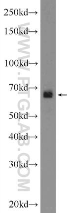 SCNN1A Antibody in Western Blot (WB)