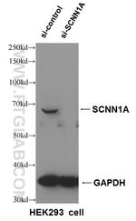 SCNN1A Antibody in Western Blot (WB)
