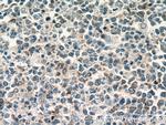 CXCL13/BCA1 Antibody in Immunohistochemistry (Paraffin) (IHC (P))
