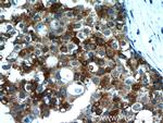 CXCL13/BCA1 Antibody in Immunohistochemistry (Paraffin) (IHC (P))