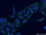 HSD11B1 Antibody in Immunocytochemistry (ICC/IF)