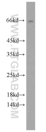 HSD11B1 Antibody in Western Blot (WB)