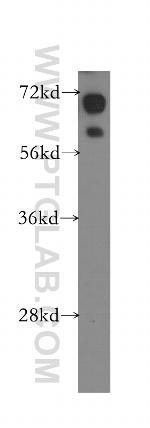 HSD11B1 Antibody in Western Blot (WB)