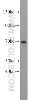HSD11B1 Antibody in Western Blot (WB)
