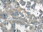 ARPC4 Antibody in Immunohistochemistry (Paraffin) (IHC (P))