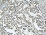 ARPC4 Antibody in Immunohistochemistry (Paraffin) (IHC (P))