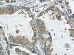 ARPC4 Antibody in Immunohistochemistry (Paraffin) (IHC (P))