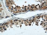 ARPC4 Antibody in Immunohistochemistry (Paraffin) (IHC (P))