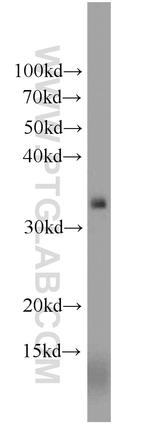 NKG2A Antibody in Western Blot (WB)