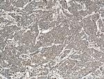 TPK1 Antibody in Immunohistochemistry (Paraffin) (IHC (P))
