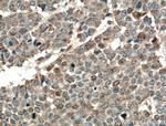TPK1 Antibody in Immunohistochemistry (Paraffin) (IHC (P))