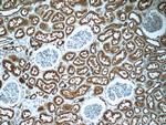 TPK1 Antibody in Immunohistochemistry (Paraffin) (IHC (P))