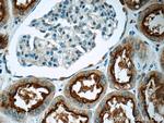 TPK1 Antibody in Immunohistochemistry (Paraffin) (IHC (P))