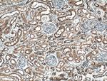 TPK1 Antibody in Immunohistochemistry (Paraffin) (IHC (P))