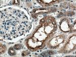 TPK1 Antibody in Immunohistochemistry (Paraffin) (IHC (P))