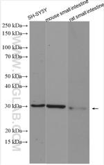 TPK1 Antibody in Western Blot (WB)