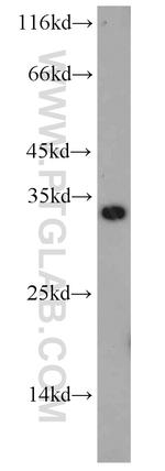 TPK1 Antibody in Western Blot (WB)