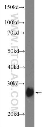 TPK1 Antibody in Western Blot (WB)