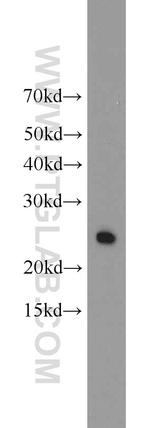 TPK1 Antibody in Western Blot (WB)